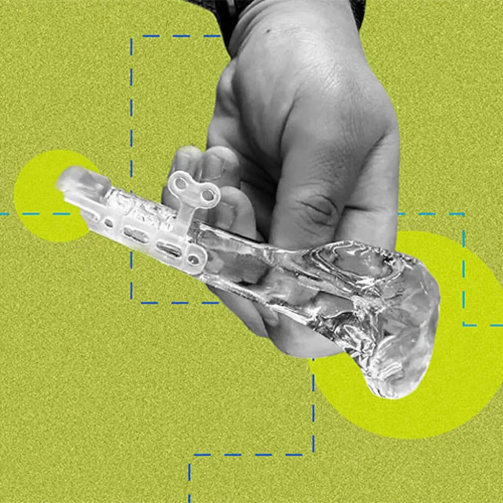 Custom, Comfortable, and Affordable Prosthetics for Animals (and Humans)  